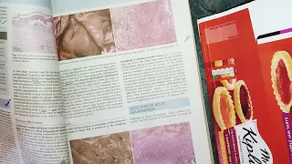 Morphology of Acute Inflammation, #inflammation #robbins #pathology #general_pathology