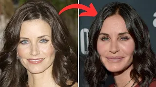 Top 10 Actors Whose Careers Were Destroyed By Plastic Surgery