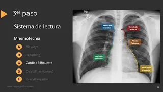 Tutorial Radiografía de Torax