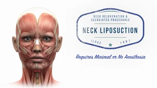 Neck Lift 101: Plastic Surgery Techniques for the Neck | Aesthetic Minutes #NeckLift