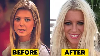 25 Actresses Plastic Surgery Disasters