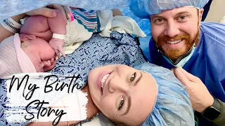 POSITIVE C-SECTION BIRTH STORY | Breech Baby | Scheduled C-Section