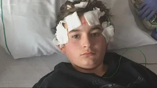 Boy, 12, undergoes brain surgery while awake