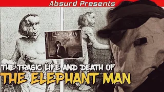 The Tragic Life And Death Of The Elephant Man