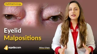 Eyelid Malpositions | Ophthalmology Lecture | Medical V-Learning Education | sqadia.com