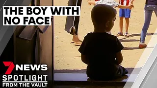 The boy with no face: the incredible story of Yahya | 7NEWS Spotlight