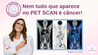 Nem tudo que aparece no PET SCAN é câncer!