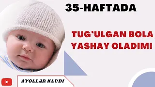 HOMILADORLIKNING 35-HAFTASI TUG’ULGAN BOLA YASHAY OLADIMI