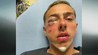 Trooper suspended after 15-year-old says he was beaten while playing ding-dong-ditch