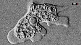 How dangerous are brain eating amoeba?