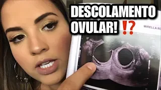 Tive um DESCOLAMENTO OVULAR | Como Descobri