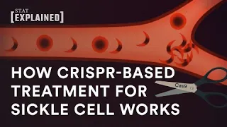 New CRISPR-based sickle cell treatment, explained