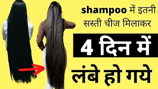 डॉक्टर भी हैरान है, कि shampoo में इतनी सस्ती चीज मिलाकर | 4 दिन में बाल कैसे लंबे हो गये  #hairgrow