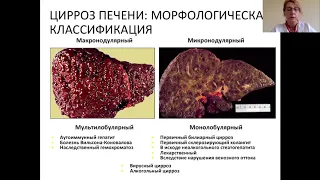 Цирроз печени и его осложнения