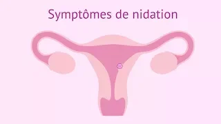 Symptômes de nidation