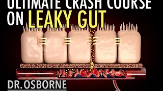 Ultimate Crash Course on Leaky Gut