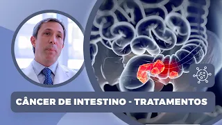 Câncer de intestino | Tratamentos