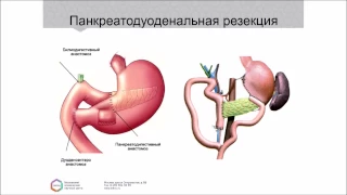 Функциональное состояние поджелудочной железы при различных заболеваниях.