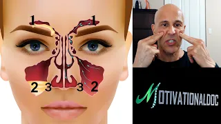 Dr. Mandell's Sinus Tapping (60 Seconds) for Instant Drainage, Headaches, and Tinnitus