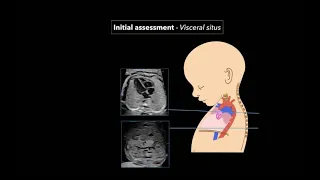 Fetal Echocardiography: Protocol and Technique