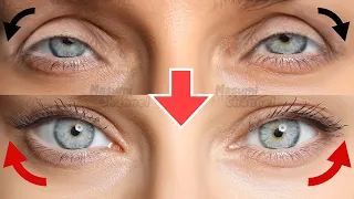 Cat Eyes Lift Massage! How To Create Fox Eyes/Cat Eyes Naturally, Get Bigger Eyes, Fix Droopy Eyelid