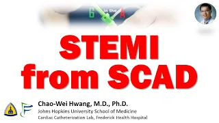 STEMI from SCAD