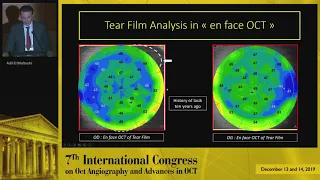 Solix | Anterior Segment Applications (Rome Symposium 2019 - A. El Maftouhi, OD)