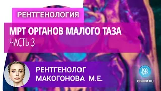 Рентгенолог Макогонова М.Е.: МРТ органов малого таза. Часть 3