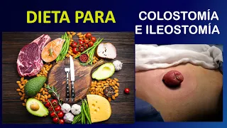 🥗 𝗗𝗜𝗘𝗧𝗔 para Ileostomía y Colostomía