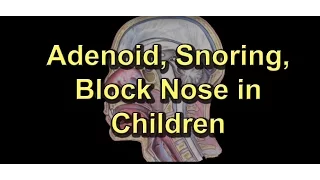 Adenoiditis, Adenoid Surgery, Snoring, Block nose/Runny nose in children