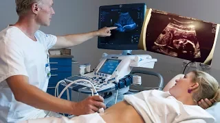 10 Ultraschallbilder die Albträume verursachen | MythenAkte