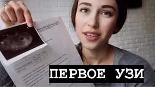 ПЕРВОЕ УЗИ🙌🏻ОТСЛОЙКА / ТОКСИКОЗ /
        5- 7 НЕДЕЛЬ БЕРЕМЕННОСТИ🤍