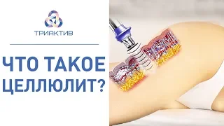 🍏 Самая эффективная аппаратная процедура против целлюлита. Процедуры против целлюлита. 12+