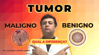 Tumor Benigno vs Maligno: Saiba a Diferença e Previna-se.