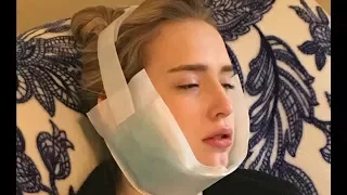 Izzy gets loopy after WISDOM TOOTH SURGERY