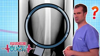 How Strong Are Our Bones? 🩹 | Full Episode | Operation Ouch