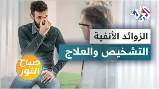 الزوائد اللحمية في الأنف .. الأسباب والأعراض وطرق العلاج