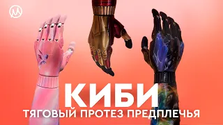 Активный протез предплечья CYBI Hand: простое использование, расширенный функционал