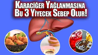 Karaciğer Yağlanmasına Bu 3 Yiyecek Sebep Olur ! Sonu Ölümcüldür Uzak Durun!