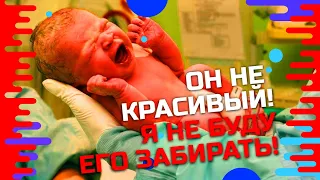 Мать оставила малыша в роддоме, потому что он был некрасивым! Как сложилась жизнь мальчика спустя...