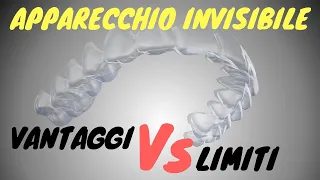 Apparecchio invisibile: vantaggi e limiti