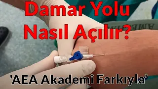 Damar Yolu Nasıl Açılır?