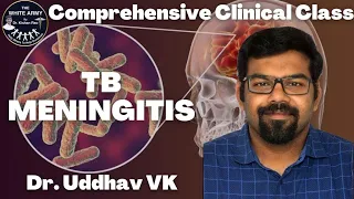 Tubercular Meningitis Case Presentation