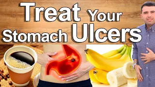 Do This And Cure Your Stomach Pain, Gastritis and Ulcers - Best Natural Treatment of Stomach Pain