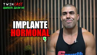 Tudo sobre implante hormonal