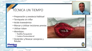 Alternativas en el tratamiento de infecciones periprotésicas ¿Es seguro?