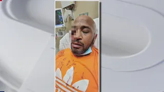 EXCLUSIVE: Houston man loses eye during attack at store