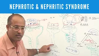 Nephrotic and Nephritic Syndrome | Causes Symptoms & Treatment🩺