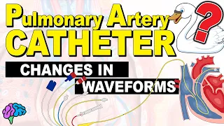 Changes to our PA Catheter Waveforms and Values!