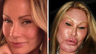 9 People Who Took Plastic Surgery Way Too Far
